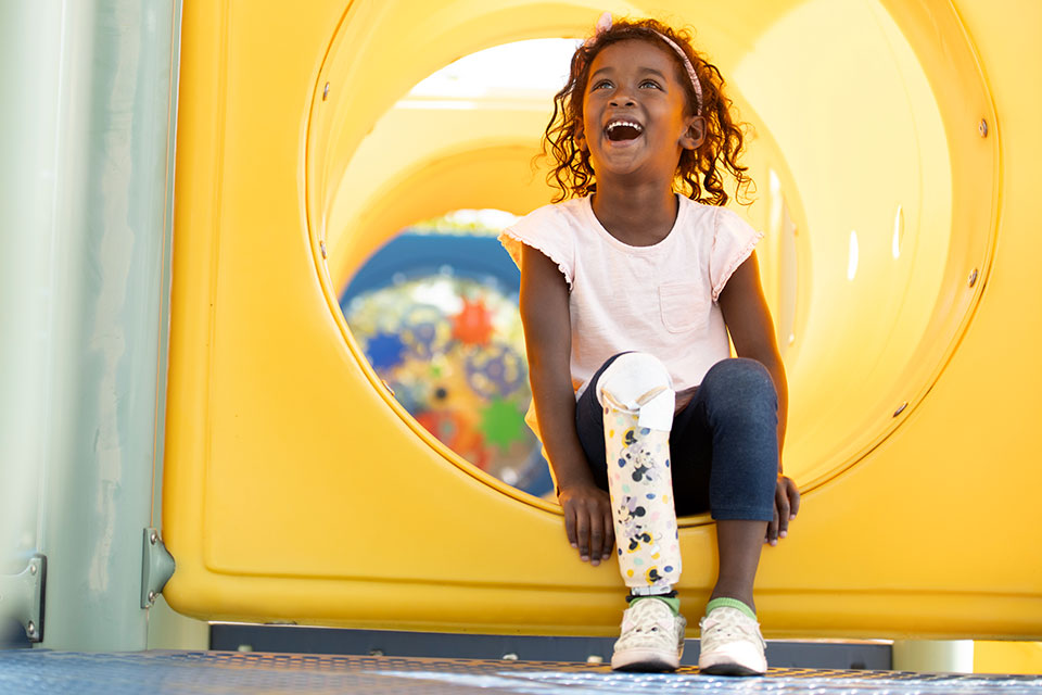 young female wearing prosthetic leg on playground
