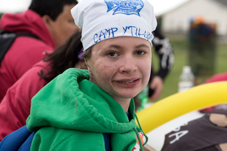 burn patient at Camp Ytiliba