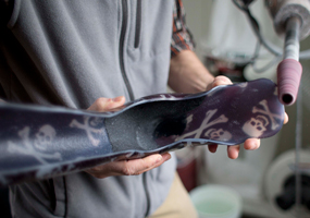 staff member holding prosthetic device