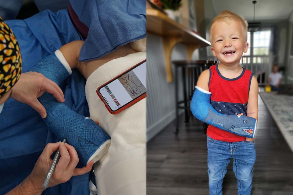 Le patient Keaton avec un requin dessiné sur son plâtre et post-opératoire avec un plâtre de requin