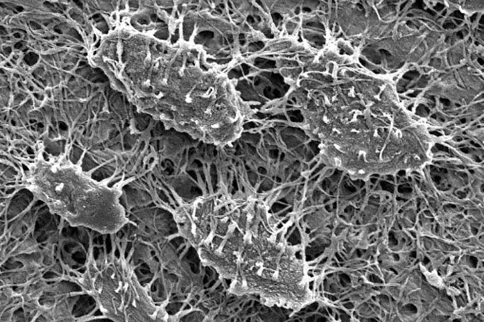 Células óseas vistas a través del microscopio