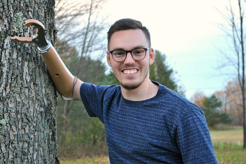 Lucas con su prótesis de brazo apoyado en un árbol