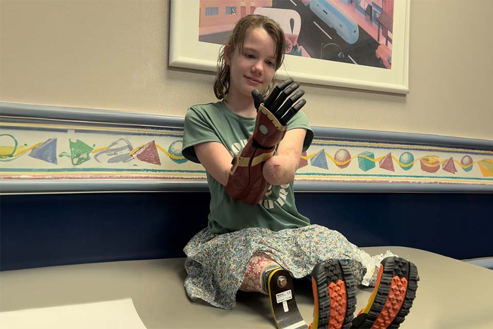 Rosie wearing arm and leg prosthetics