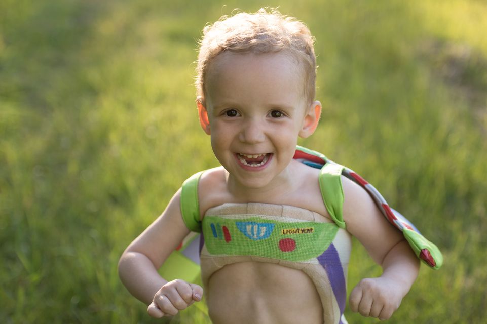 male patient wearing scoliosis brace