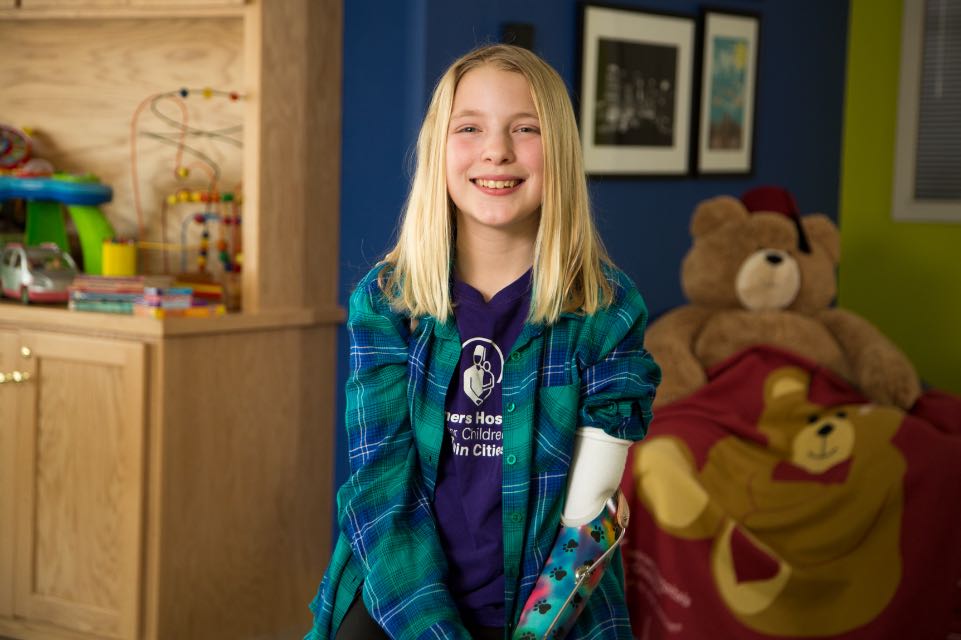 Patient with prosthetic arm